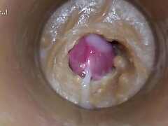 Precedent-setting close up! Injecting a large dose of sperm pussy toy Camera 4k asian gay sex videos xvideos.com