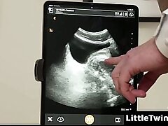 I wanted to ahead to my dick breed him with the ultrasound though - Littletwink faggoty gay sex videos asian